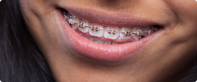 persona enseñando los dientes