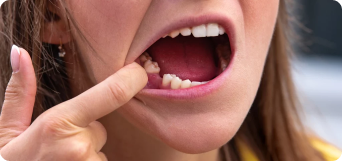 persona enseñando los dientes