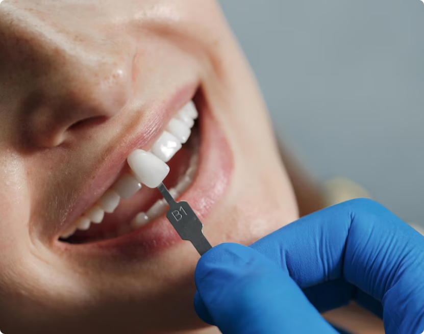 persona enseñando los dientes