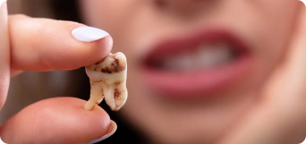 persona enseñando los dientes