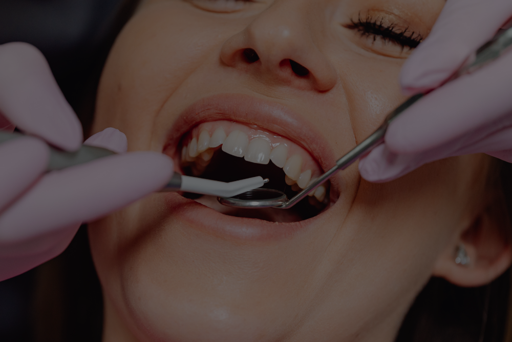 How Long Do Dental Implants Last? Tips for a Lifetime Smile