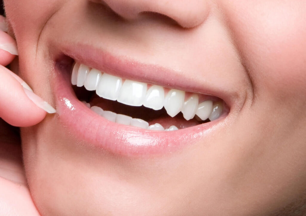 Professional Teeth Whitening in Tijuana